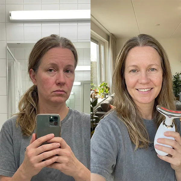 Before/After - Annemieke