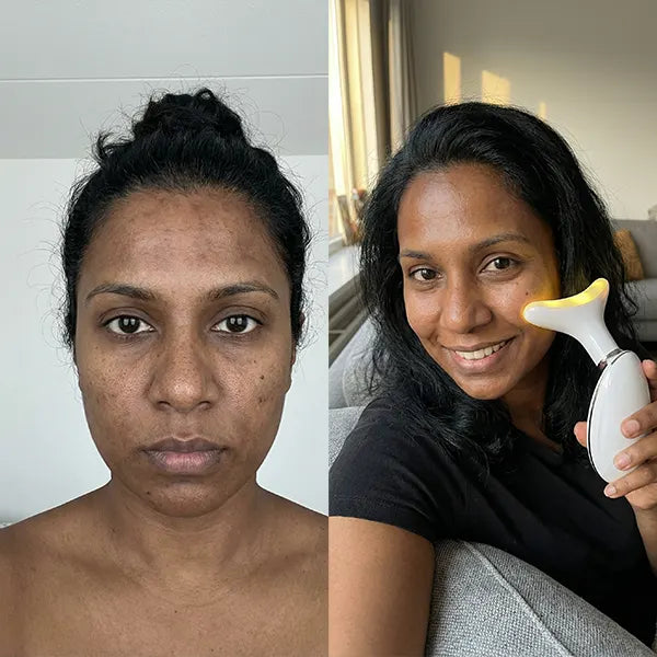 Before/After - Françoise