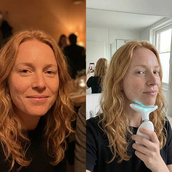 Before/After - Catherine