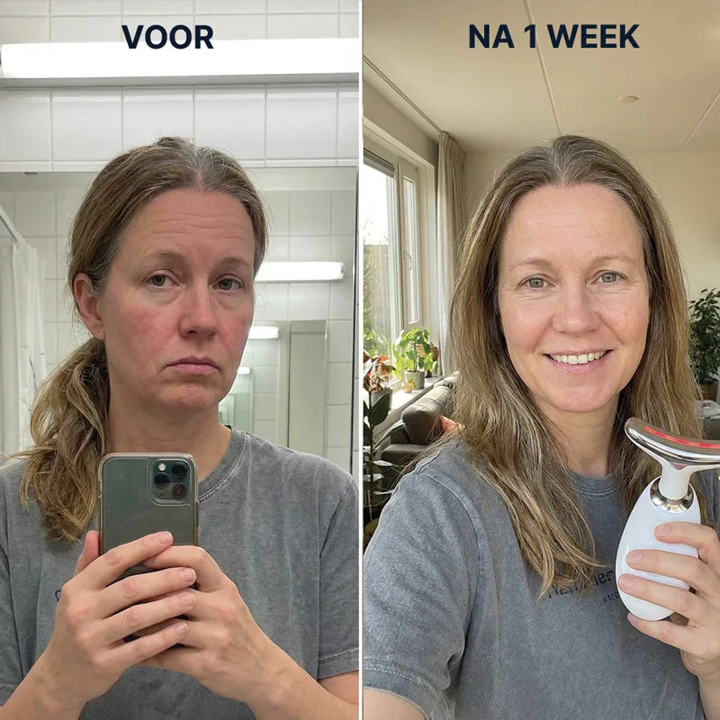 Jovëa FaceLift EMS - Jonger in 30 dagen zonder naalden