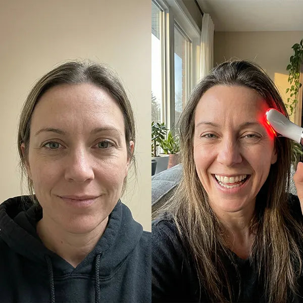 Before/After - Denise